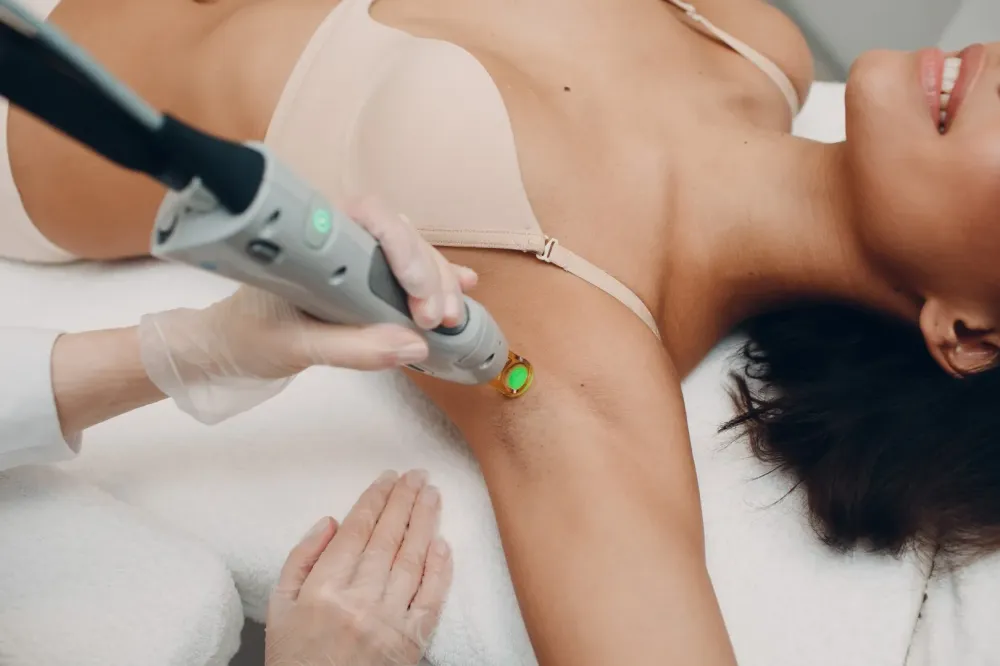 epilations laser
